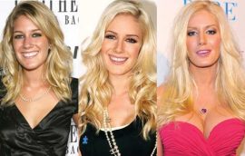 Heidi Montag Before and After